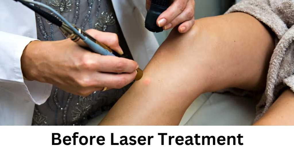 Before Laser Treatment