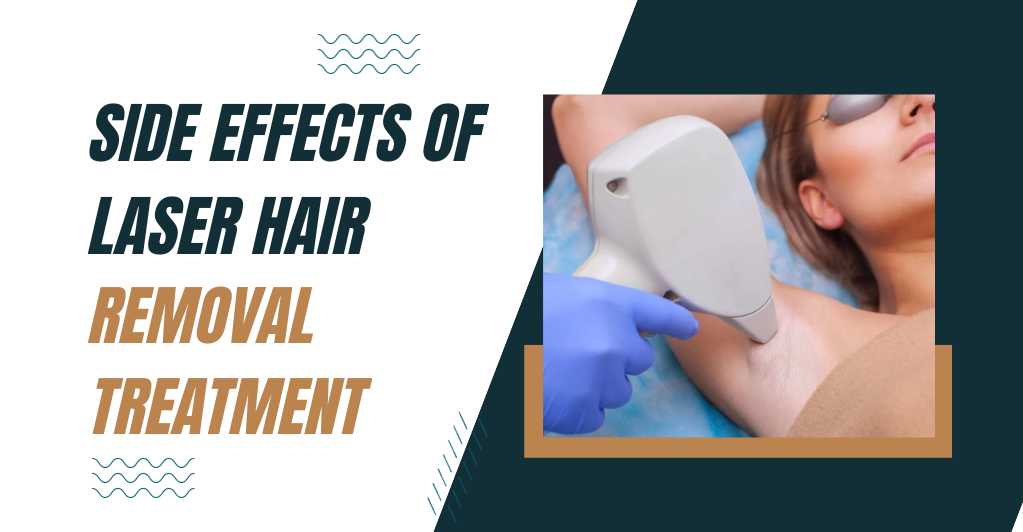 Side effects of Laser hair removal treatment