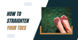 How To Straighten Your Toes: 5 Treatment Options That Work!