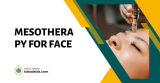 Mesotherapy For Face: What Is It and Its Benefits
